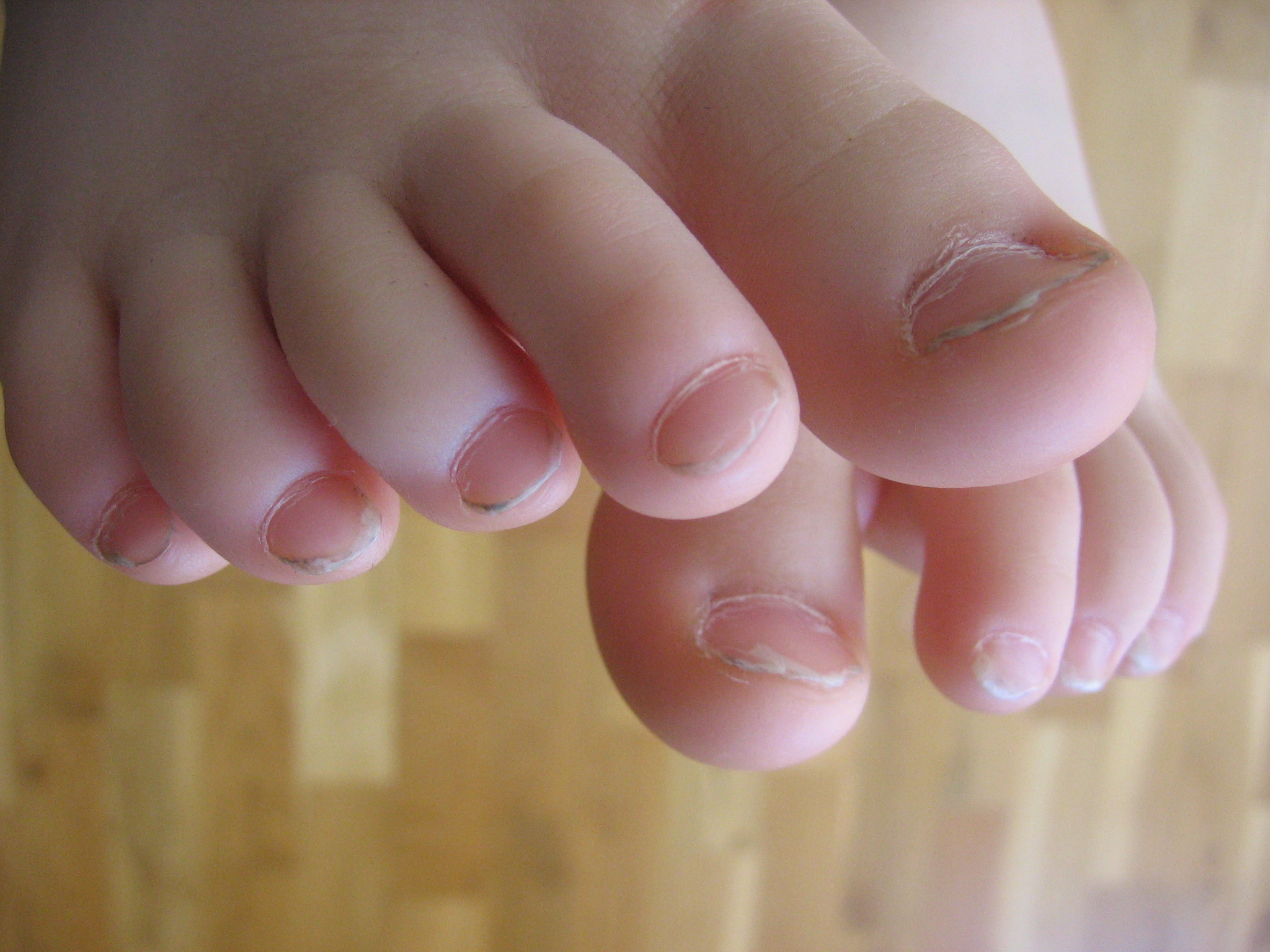 little_toes01.jpg